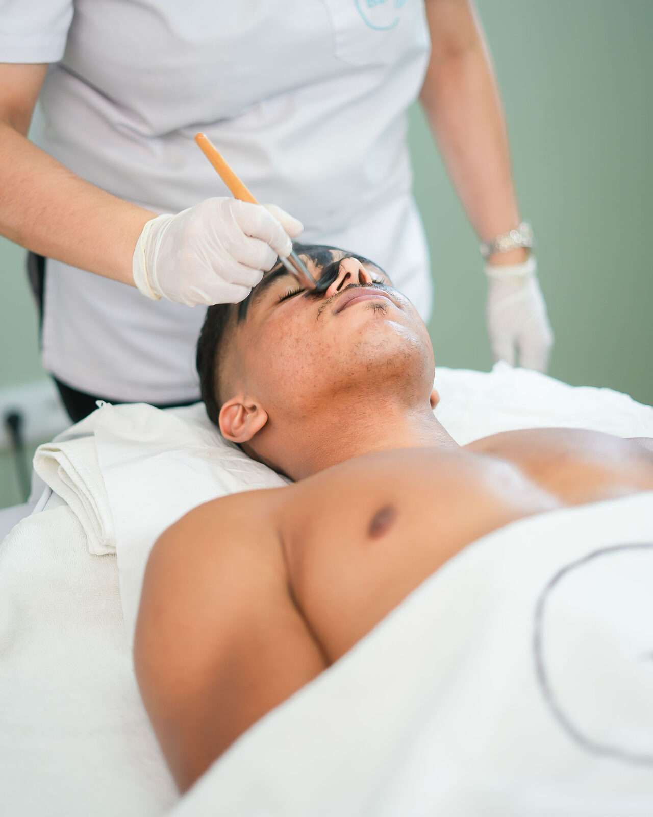 Microneedling casablanca rabat centre esthétique