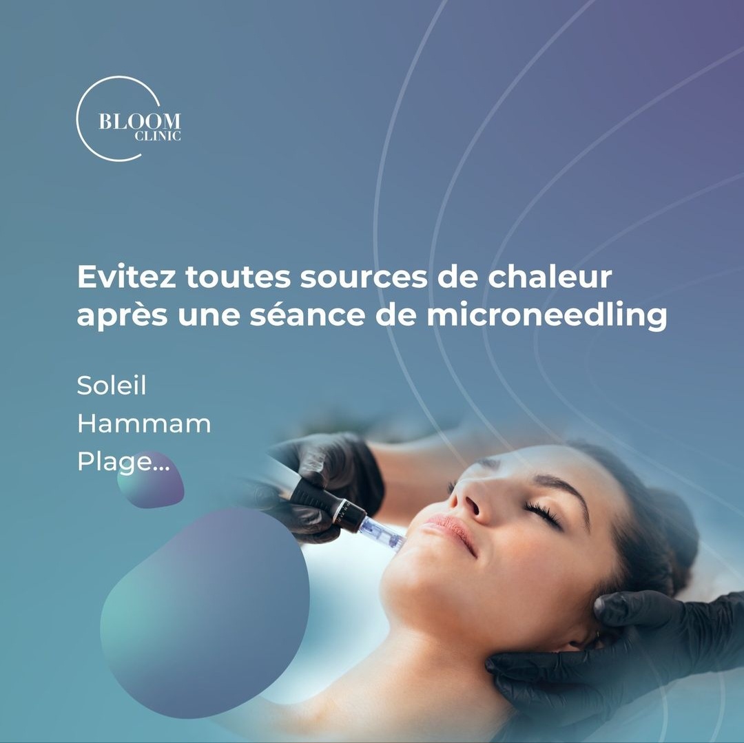 Microneedling casablanca rabat centre esthétique Microneedling casablanca rabat centre esthétique