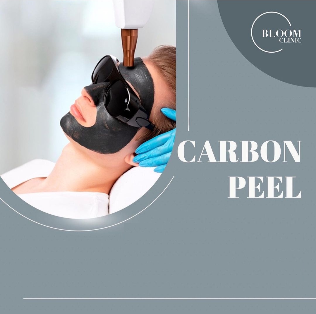 carbon laser peel casablanca rabat centre esthétique Bloom Clinic